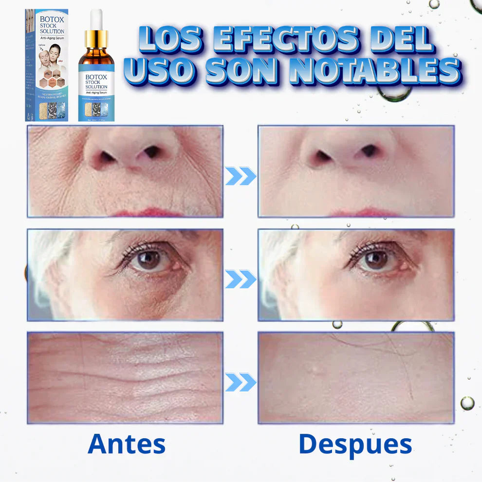 🌸🌺 Sérum Magic Botox – Rejuvenece tu piel sin agujas 🌺 🌸