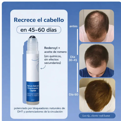 BODYWISE™: Roll On Capilar de Triple Acción que Reactiva Folículos y Fortalece el Crecimiento del Cabello